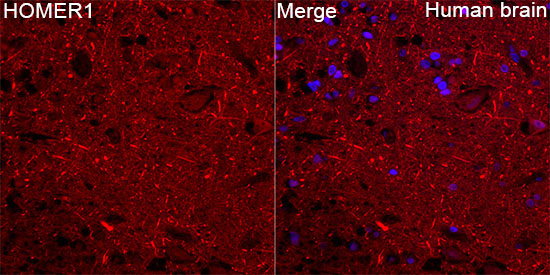 HOMER1 Rabbit Polyclonal Antibody