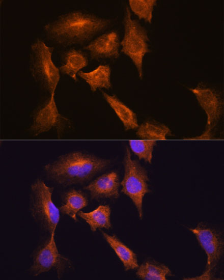 HOOK3 Rabbit Polyclonal Antibody - Image 2