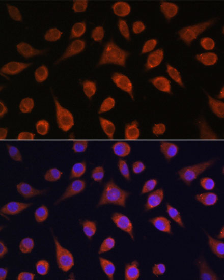 HOOK3 Rabbit Polyclonal Antibody - Image 3
