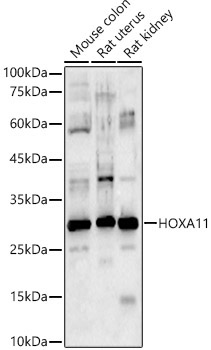 HOXA11 Rabbit Polyclonal Antibody