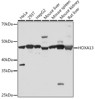 HOXA13 Rabbit Monoclonal Antibody
