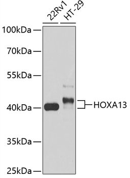 HOXA13 Rabbit Polyclonal Antibody