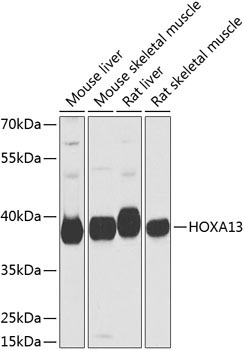 HOXA13 Rabbit Polyclonal Antibody