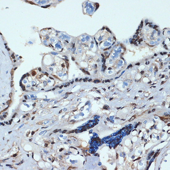 HOXA9 Rabbit Monoclonal Antibody - Image 2