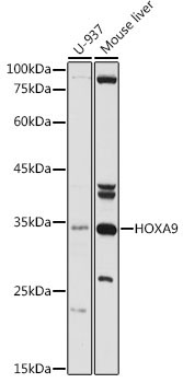HOXA9 Rabbit Polyclonal Antibody