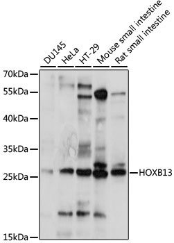 HOXB13 Rabbit Polyclonal Antibody
