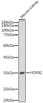 HOXB2 Rabbit Polyclonal Antibody