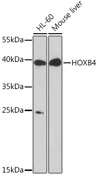 HOXB4 Rabbit Polyclonal Antibody