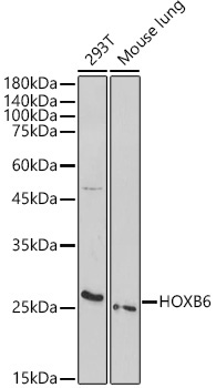 HOXB6 Rabbit Polyclonal Antibody