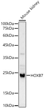 HOXB7 Rabbit Polyclonal Antibody