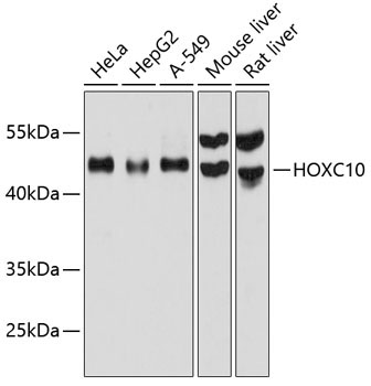 HOXC10 Rabbit Polyclonal Antibody
