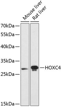 HOXC4 Rabbit Polyclonal Antibody