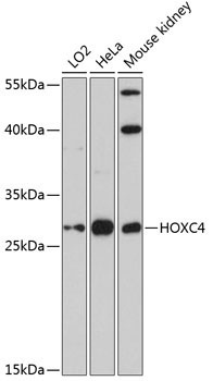 HOXC4 Rabbit Polyclonal Antibody