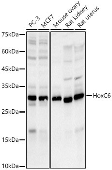 HoxC6 Rabbit Monoclonal Antibody