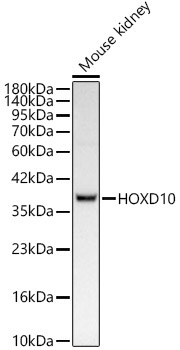 HOXD10 Rabbit Monoclonal Antibody