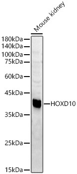 HOXD10 Rabbit Polyclonal Antibody