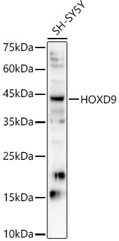 HOXD9 Rabbit Polyclonal Antibody