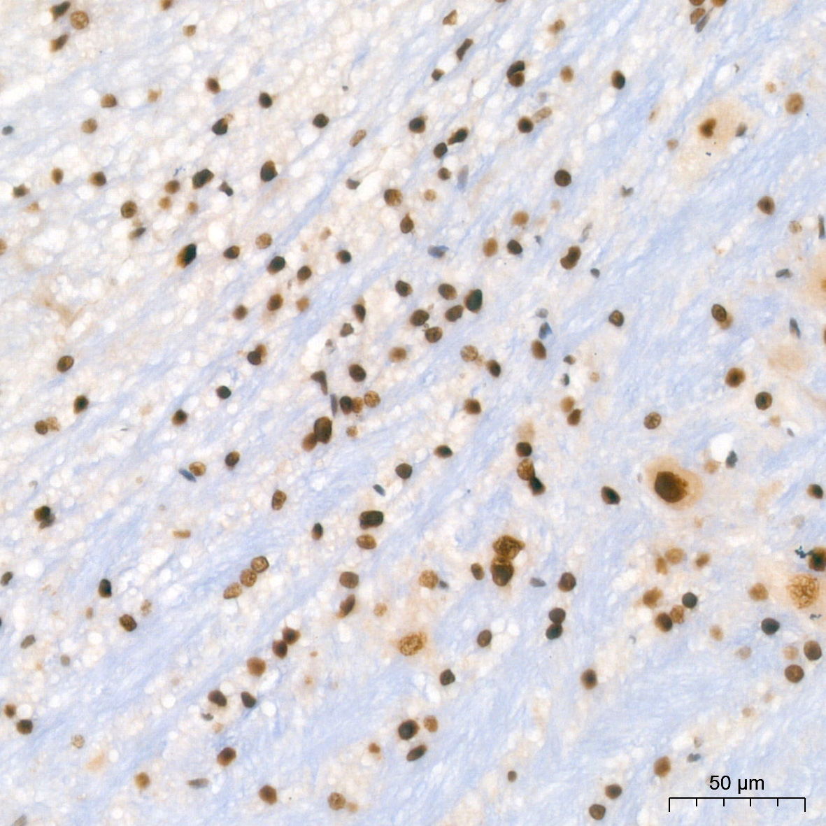 HP1 alpha/CBX5 Rabbit Monoclonal Antibody - Image 10
