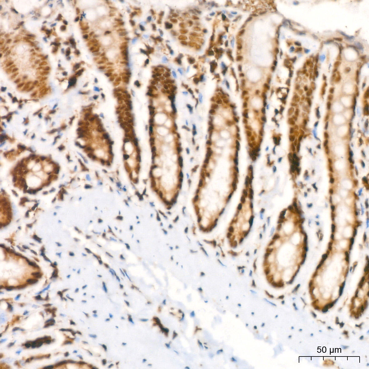 HP1 alpha/CBX5 Rabbit Monoclonal Antibody - Image 11