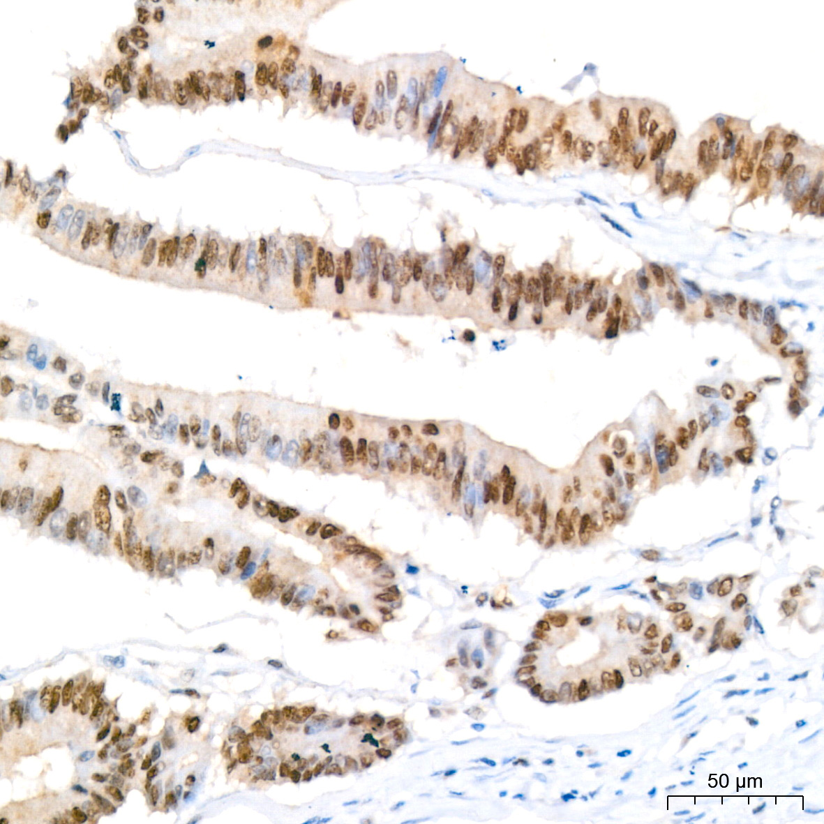 HP1 alpha/CBX5 Rabbit Monoclonal Antibody - Image 3