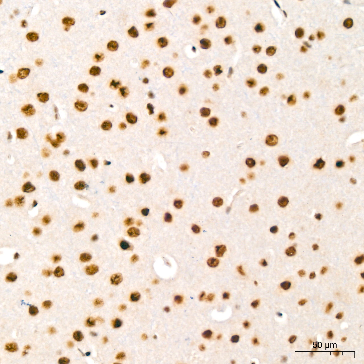 HP1 alpha/CBX5 Rabbit Monoclonal Antibody - Image 6