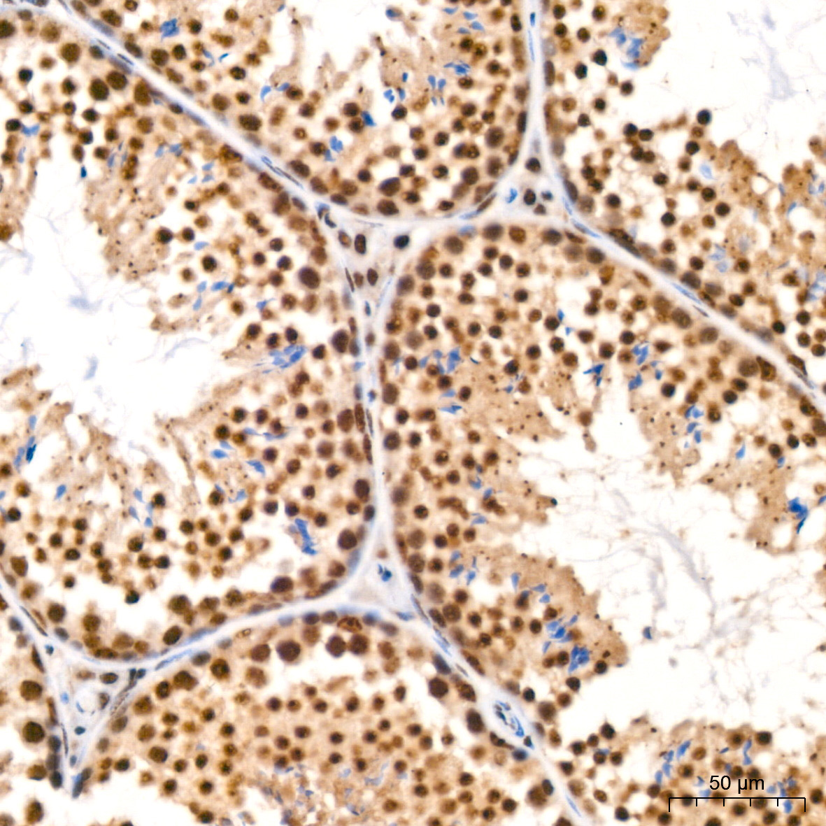 HP1 alpha/CBX5 Rabbit Monoclonal Antibody - Image 9