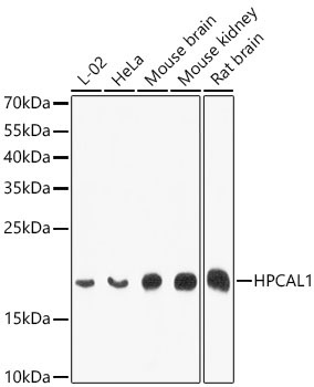 HPCAL1 Rabbit Polyclonal Antibody