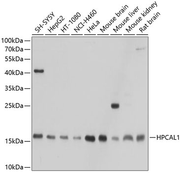 HPCAL1 Rabbit Polyclonal Antibody