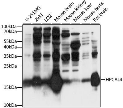 HPCAL4 Rabbit Polyclonal Antibody
