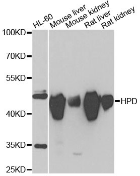 HPD Rabbit Polyclonal Antibody