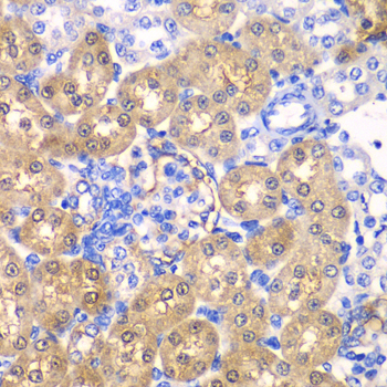 HPD Rabbit Polyclonal Antibody - Image 2