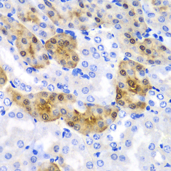 HPD Rabbit Polyclonal Antibody - Image 3