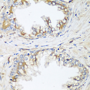 HPSE2 Rabbit Polyclonal Antibody - Image 2