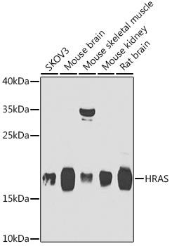 HRAS Rabbit Polyclonal Antibody