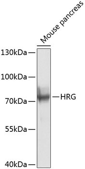 HRG Rabbit Polyclonal Antibody