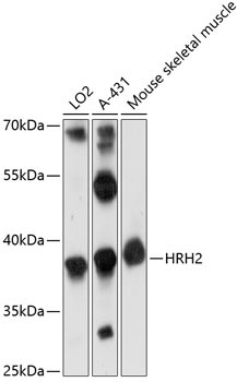 HRH2 Rabbit Polyclonal Antibody
