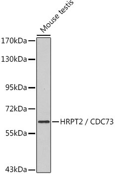 HRPT2 / CDC73 Rabbit Polyclonal Antibody
