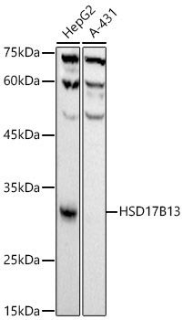 HSD17B13 Rabbit Monoclonal Antibody