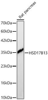 HSD17B13 Rabbit Polyclonal Antibody