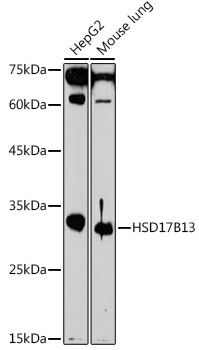 HSD17B13 Rabbit Polyclonal Antibody