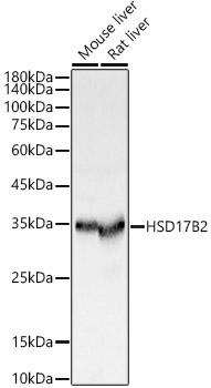 HSD17B2 Rabbit Polyclonal Antibody