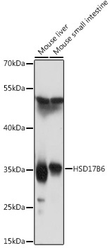 HSD17B6 Rabbit Polyclonal Antibody