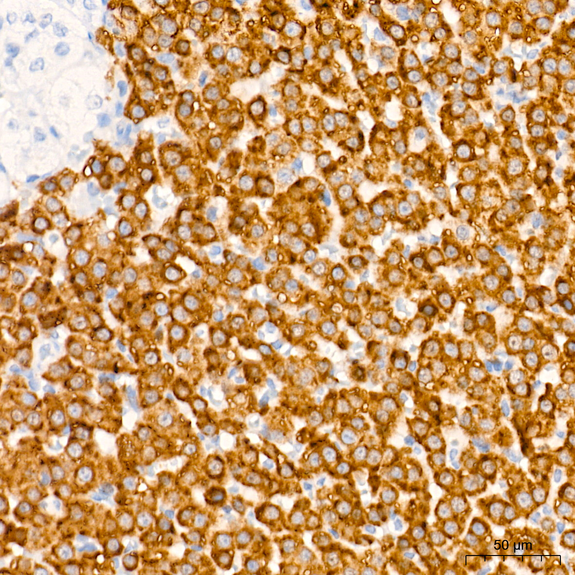 HSD3B1 Rabbit Monoclonal Antibody - Image 2