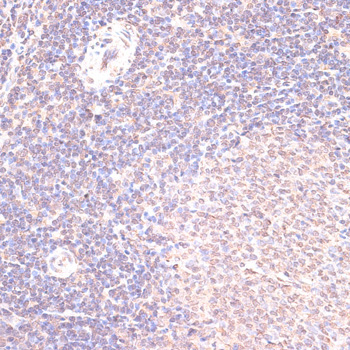 HSF1 Rabbit Polyclonal Antibody - Image 2