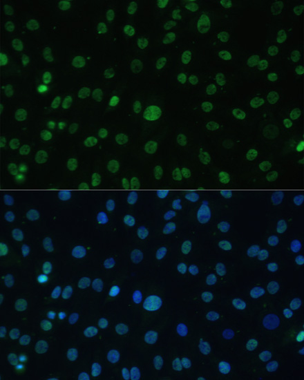 HSF1 Rabbit Polyclonal Antibody - Image 3