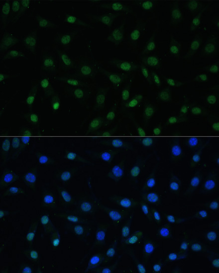 HSF1 Rabbit Polyclonal Antibody - Image 4