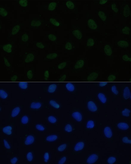 HSF1 Rabbit Polyclonal Antibody - Image 5