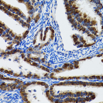 HSP105/HSPH1 Rabbit Polyclonal Antibody - Image 2