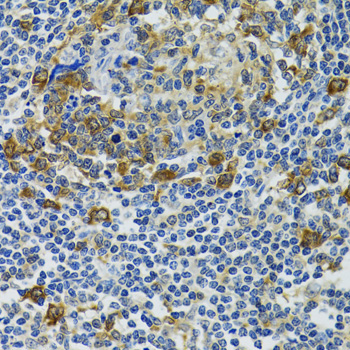 HSP105/HSPH1 Rabbit Polyclonal Antibody - Image 3