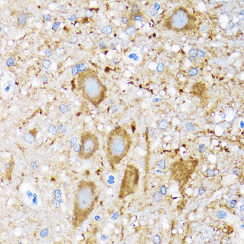 HSP105/HSPH1 Rabbit Polyclonal Antibody - Image 4